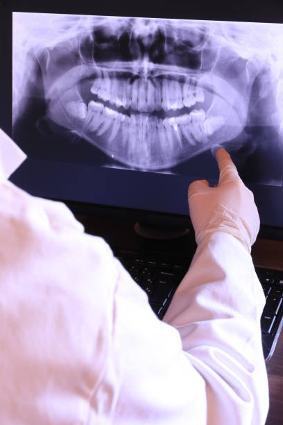 Best Dental Abscess Treatment in Covelo, CA