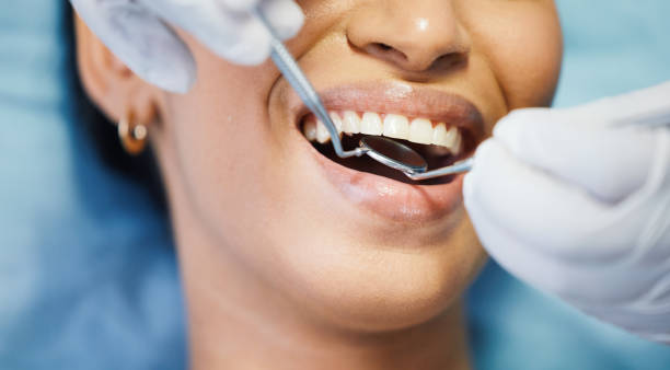 Best Broken or Chipped Tooth Repair in Covelo, CA