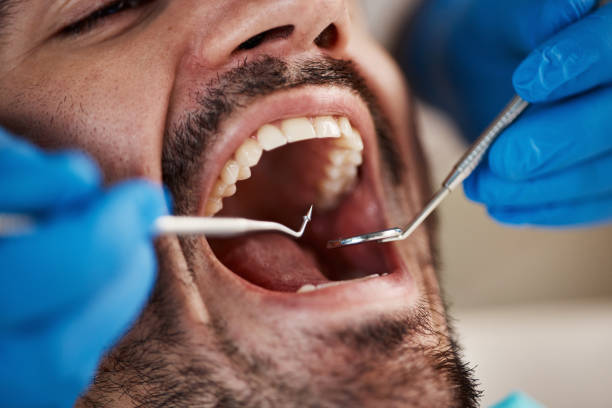 Best Emergency Cosmetic Dentistry (e.g., broken veneers) in Covelo, CA