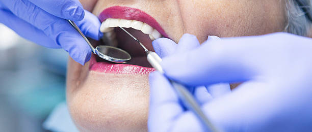 Best Emergency Wisdom Tooth Extraction in Covelo, CA